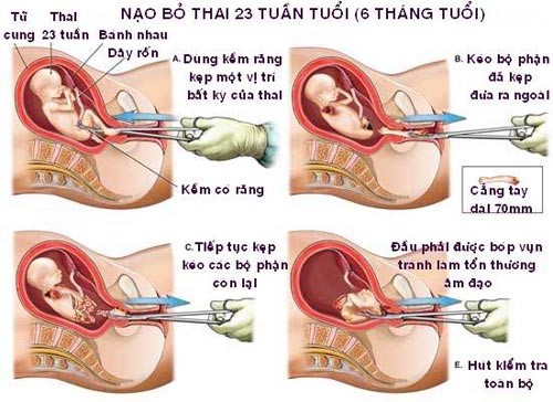 Pha Thai